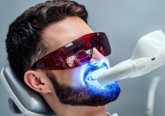 blanqueamiento dental laser guadalajara